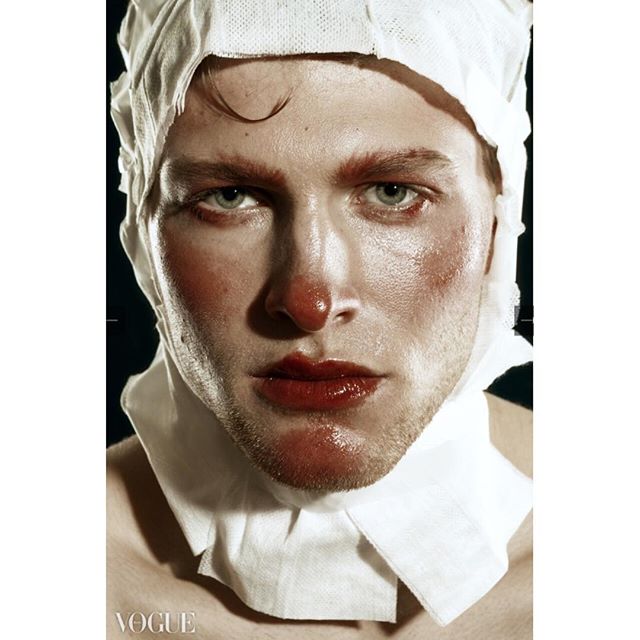 A male model with intense makeup and head bandages poses for a vogue editorial shot.