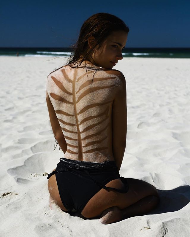 A woman sits on a sandy beach displaying a unique leaf-shaped tan line on her back, with the ocean in the background.
