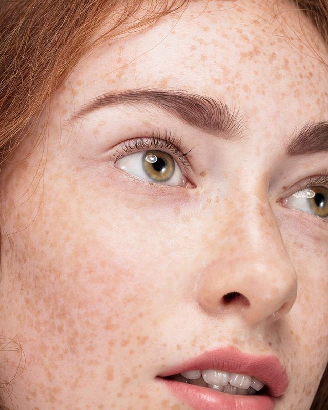Close-up of a woman's face with freckles, showcasing natural beauty and clear skin in a soft, warm light.