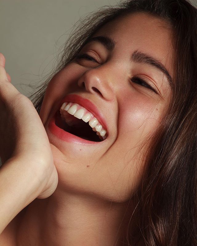 A smiling woman with an open mouth shows off her white teeth.